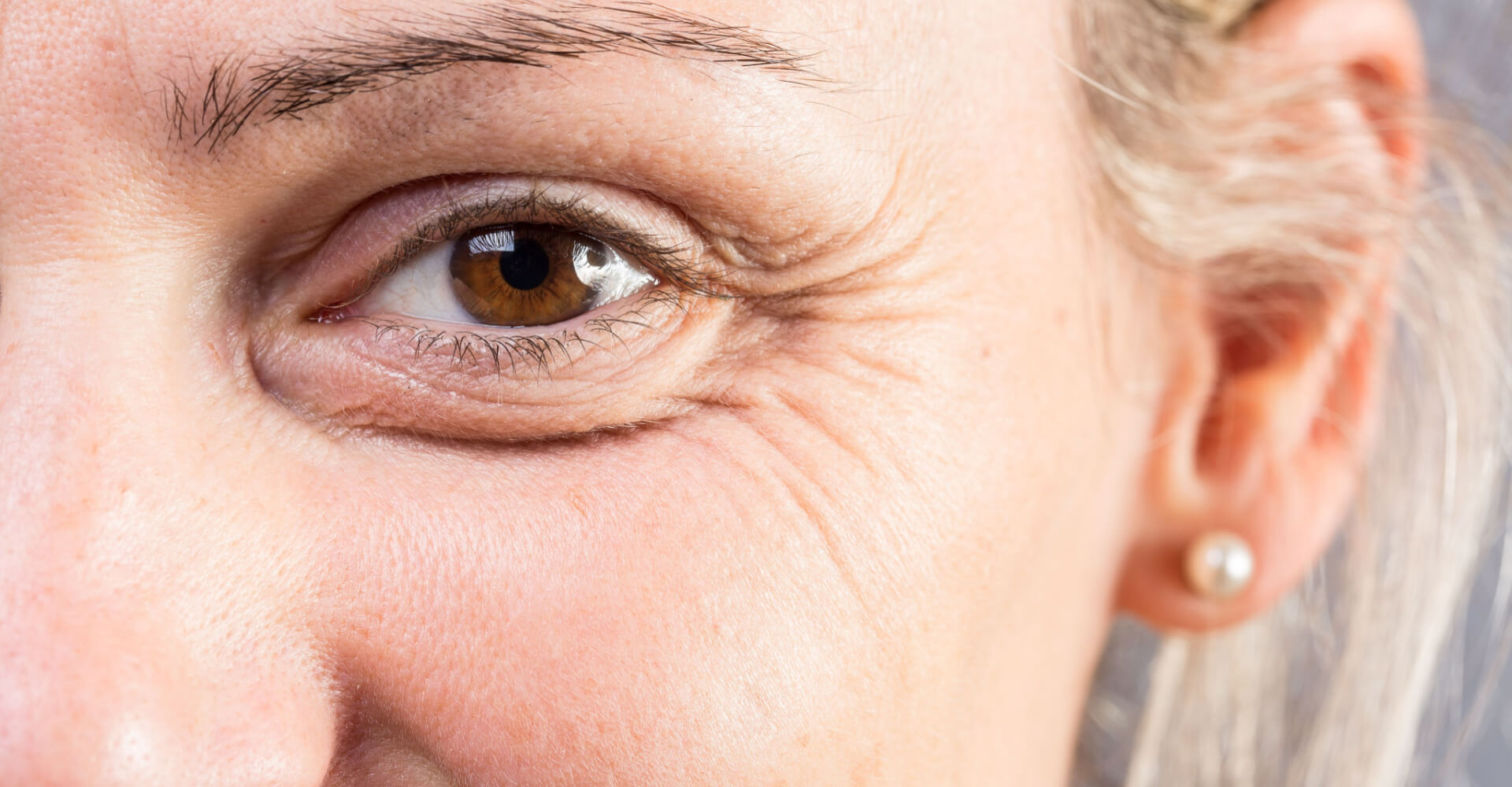 Anti wrinkle injections