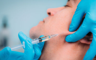 What Kind of Swelling Can I Expect After Dermal Filler?
