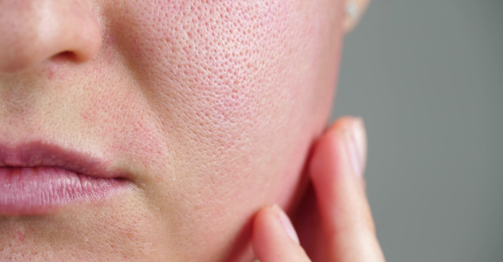 dermal fillers
