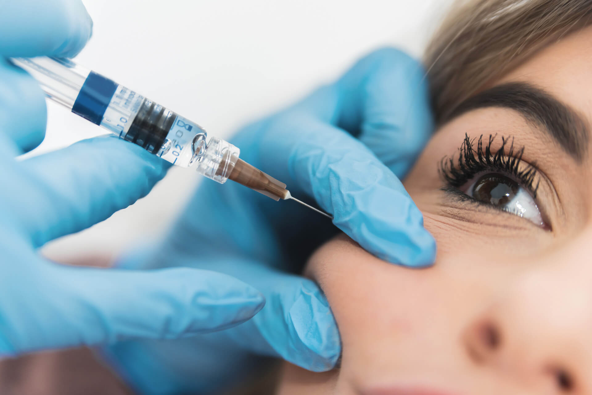 dermal fillers