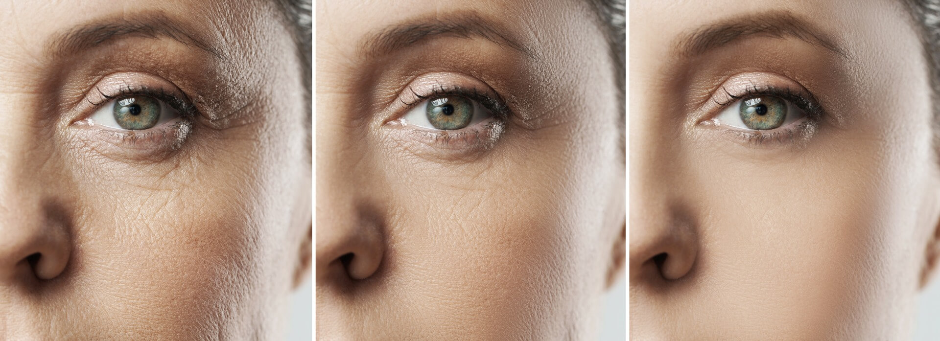 skin tightening treatment in Melbourne