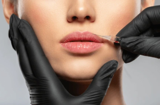 dermal fillers